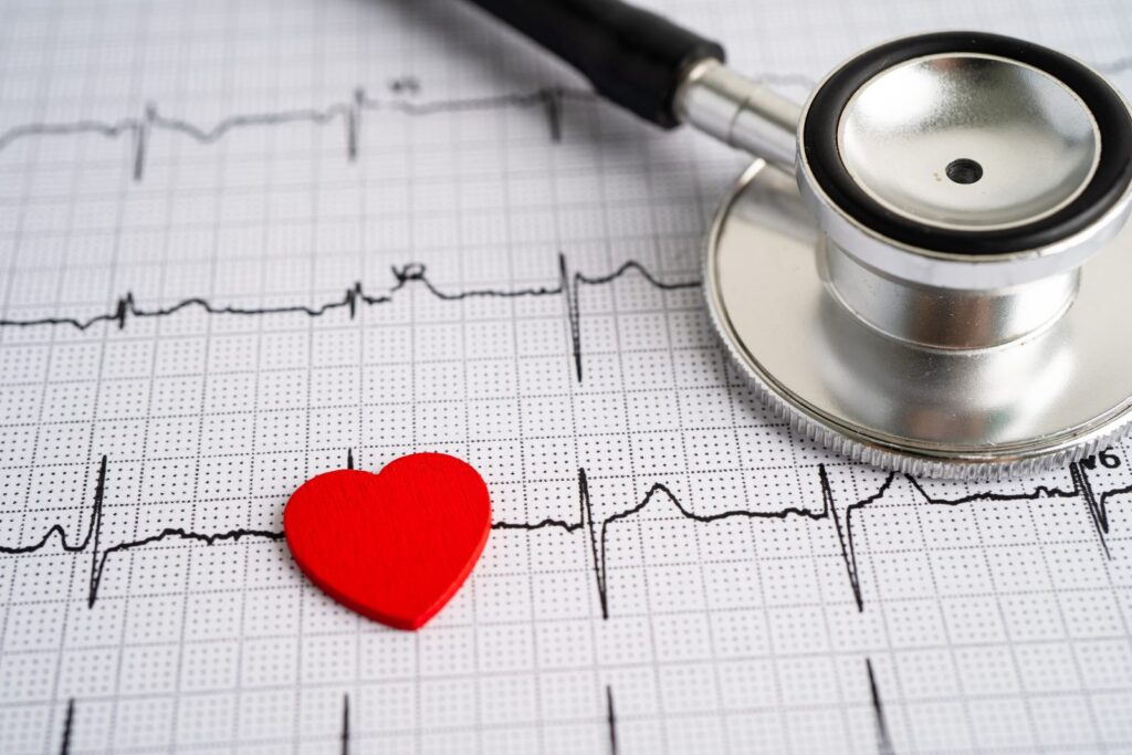 Estetoscopio sobre electrocardiograma: seguro de vida después de un infarto